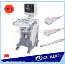 medical ultrasonic scanner & trolley B mode ultrasound machine